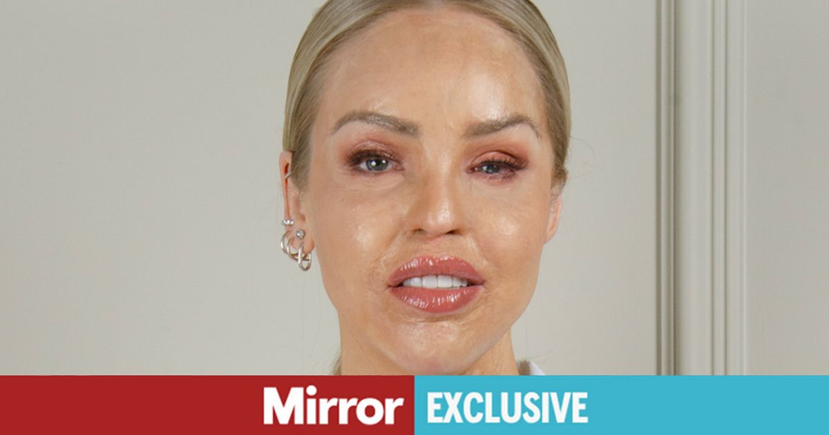41-Year-Old Katie Piper Shares Painful News
