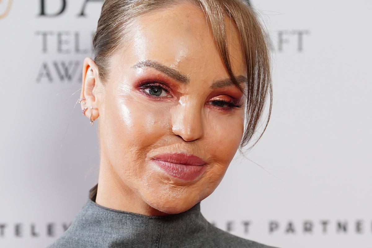 Katie Piper's Eye Surgery: A Heartbreaking Choice