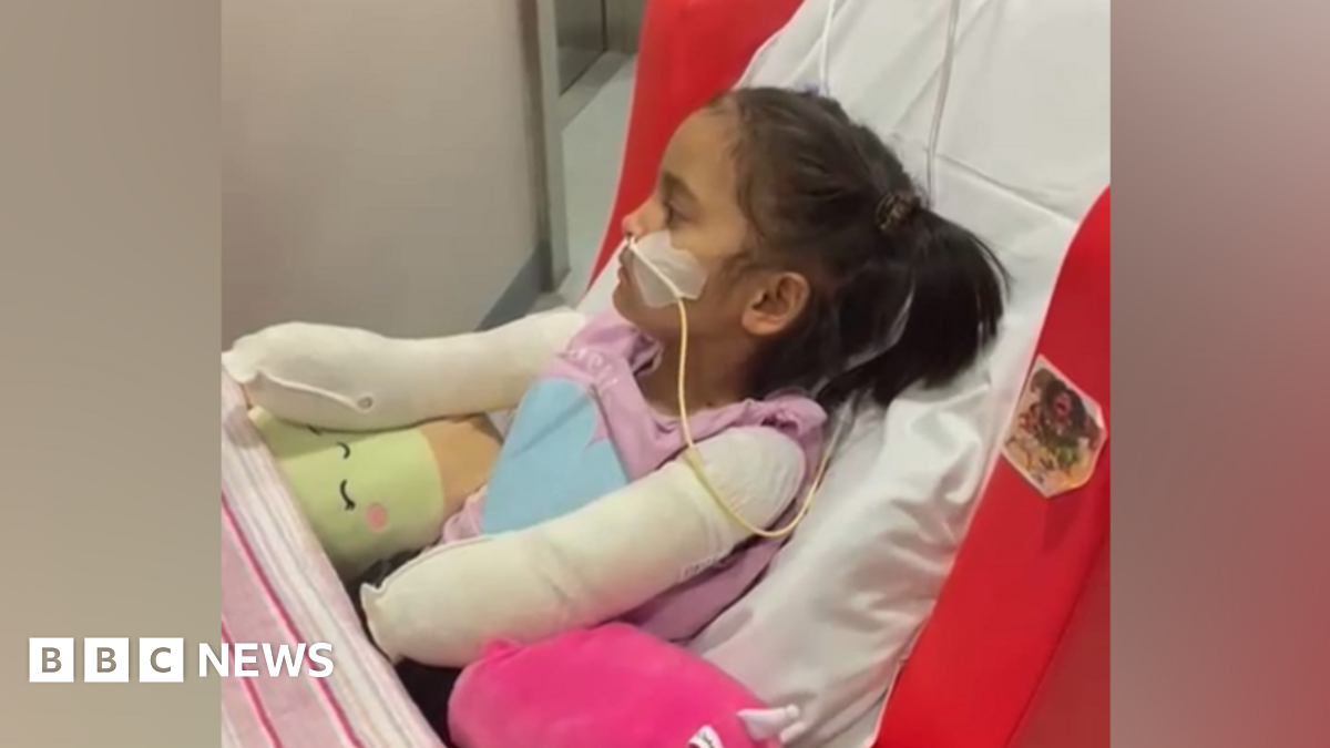 Stockton Girl's Meningitis: Quadruple Amputation