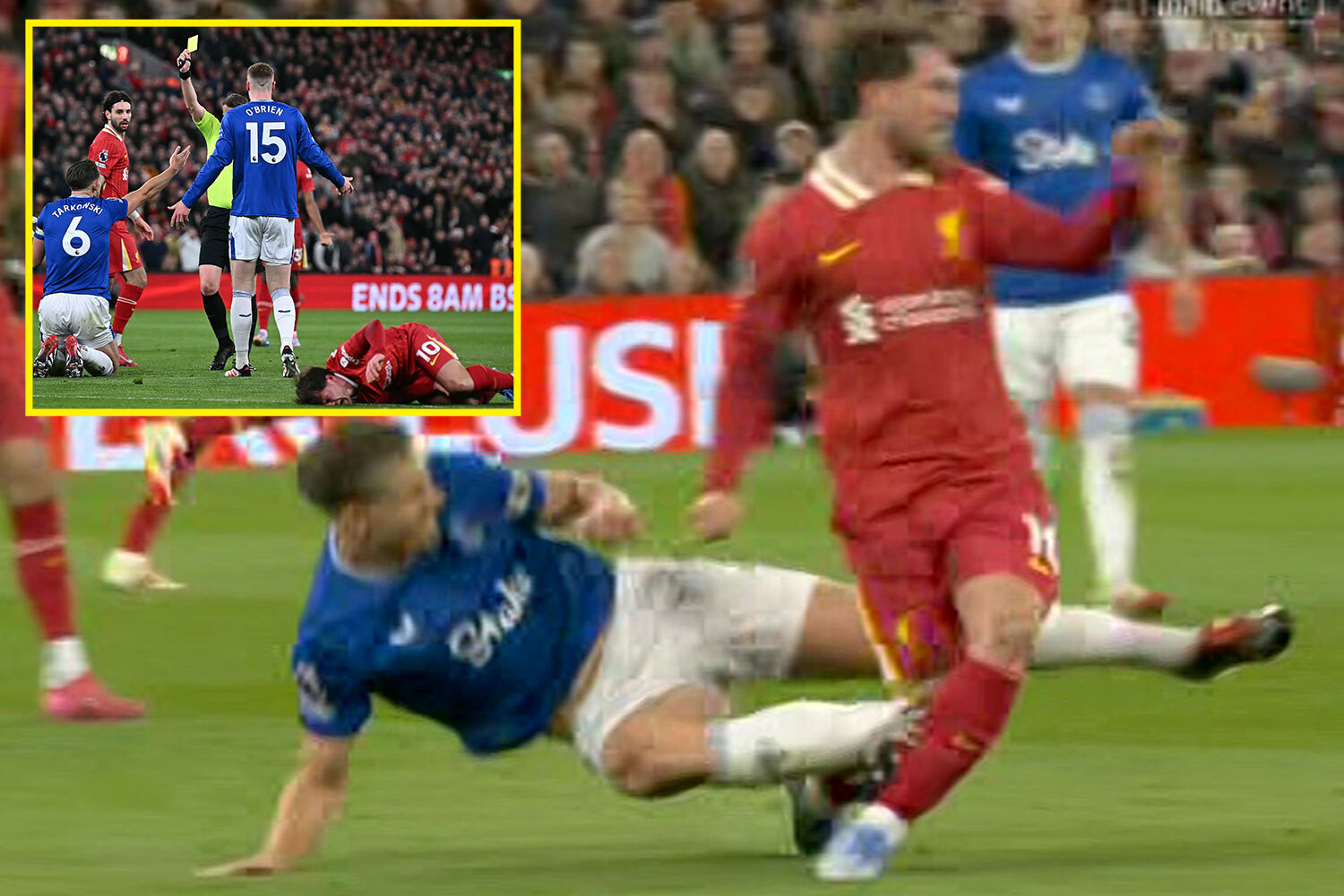 Tarkowski Escapes Red: Leg-Breaker Challenge In Derby