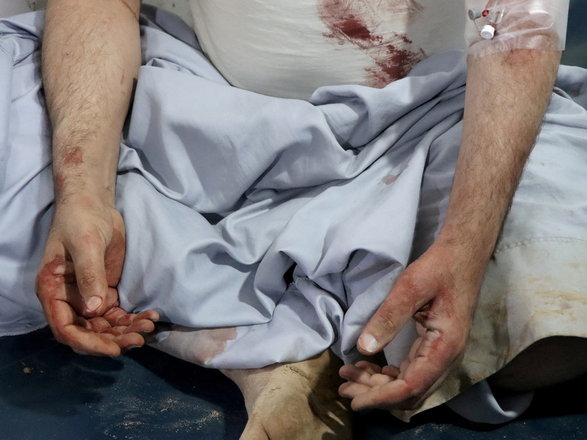 Yemeni Families: US Air Strikes Devastation